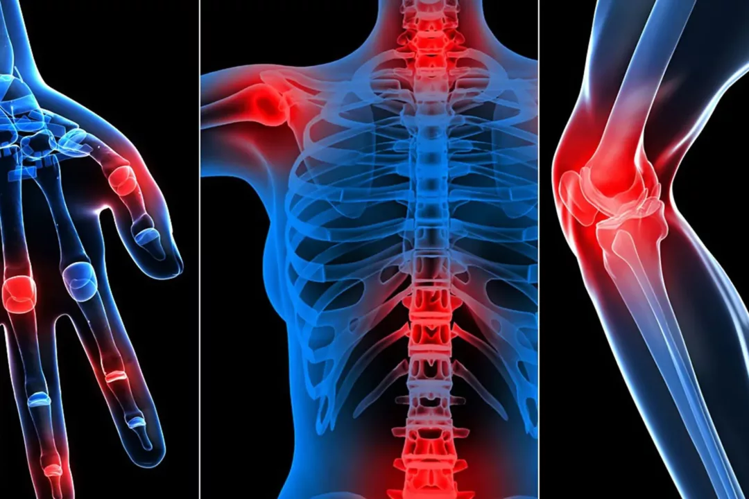 Rheumatology