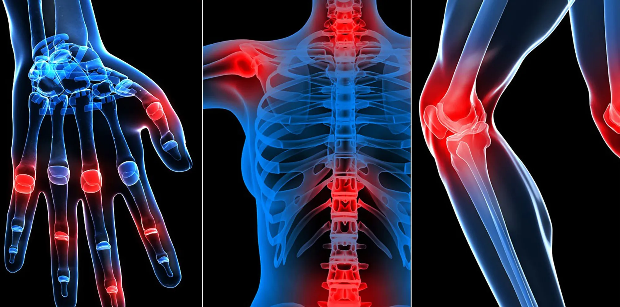 Rheumatology